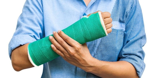 broken arm